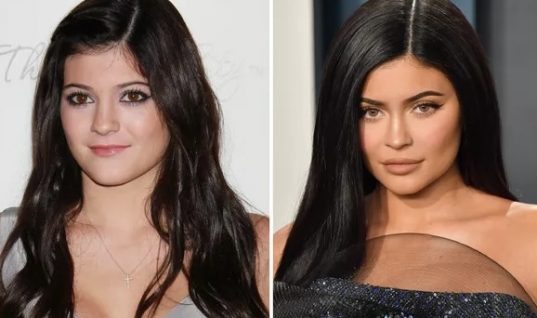 Kylie Jenner se revolta e diz que ‘não tem muitas cirurgias no rosto’ 