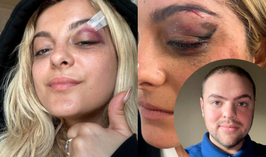 Homem que atirou celular contra o rosto de Bebe Rexha admite que fez de proposito: “achei que seria engraçado”